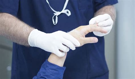 Hand Surgery Orange County Orthopedic Clinic