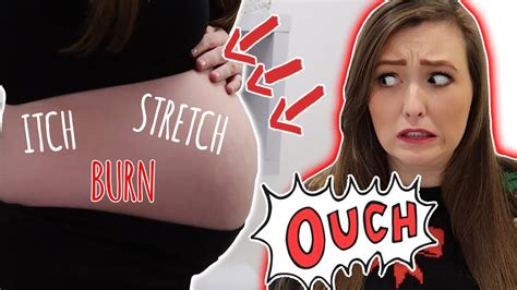 The Pregnancy Stretch Marks Are Real Youtube
