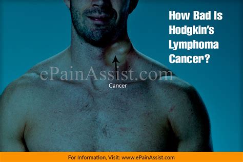 How Bad Is Hodgkins Lymphoma Cancer