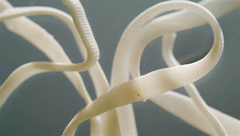 Колит кишечника диета отзывы Острый колит кишечника: симптомы и лечение заболевания Острый колит кишечника: симптомы и лечение заболевания Колит кишечника диета отзывы