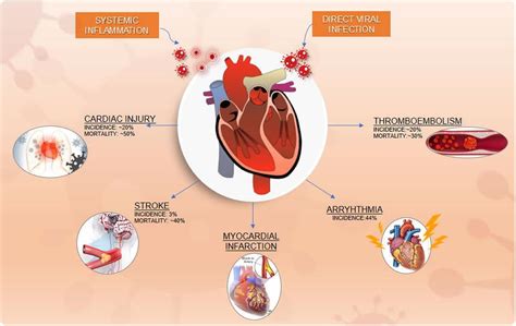 Cardiovascular Disease In Covid 19