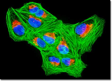 (osteosarcoma is the most common bone tumor — 85% of dogs with cancer in the bone will be diagnosed with osteosarcoma.) by looking at these cases, we can see how statistics help, but don't define, decisions about dog cancer treatment. Molecular Expressions Microscopy Primer: Specialized ...