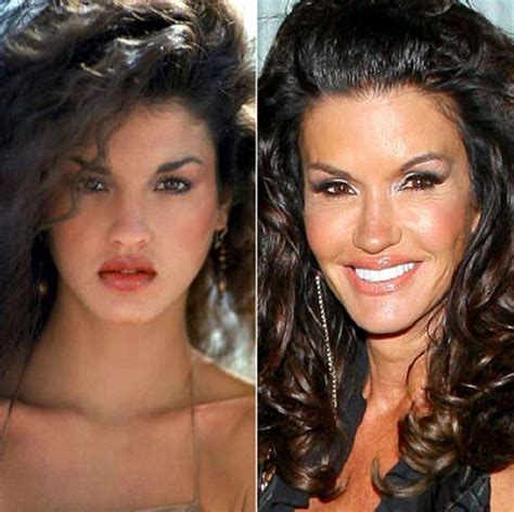 Janice Dickinson Before And After Plastic Surgery 02 Celebrity Plastic Surgery Online