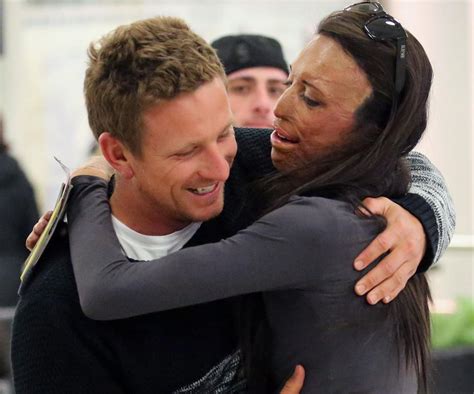 Fire Survivor Turia Pitt And Michael Hoskins Story Will Force You To Believe In True Love