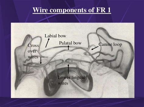 Frankels Functional Regulator Certified Fixed Orthodontic Courses