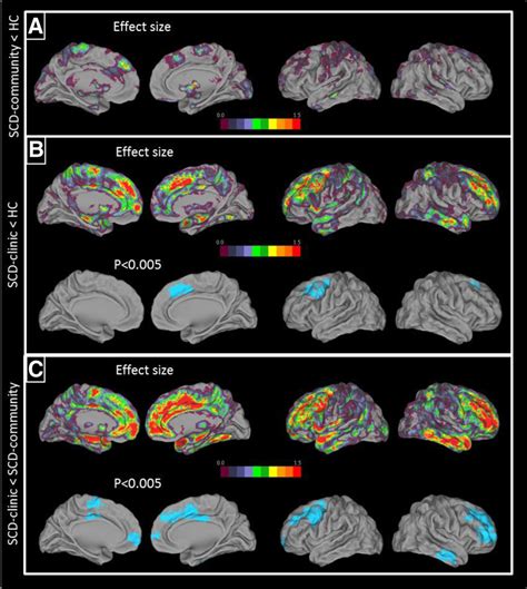 Results Of The Between Group Comparisons Of Brain Maps Of Atrophy