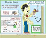 Pictures of Electrical Shock