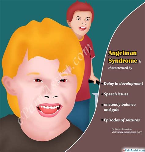 Risk Unchanged Angelman Syndrome Reproduction Online