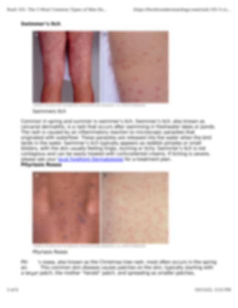 Solution Rash 101 The 5 Most Common Types Of Skin Rashes Studypool