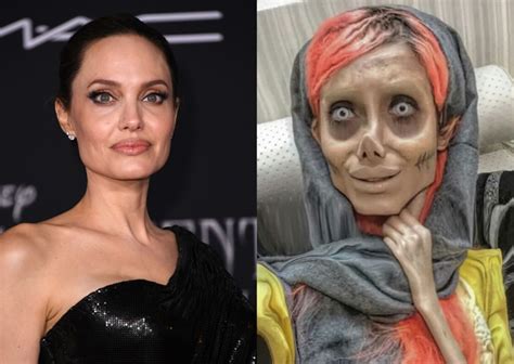 Photo Iranian Woman Who Did Multiple Cosmetic Surgeries