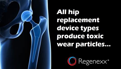 new research all hip replacement devices have wear particles regenexx