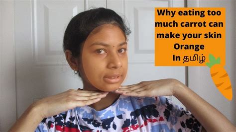 Why Eating Too Much Carrot Can Make Your Skin Orange Tamil Youtube