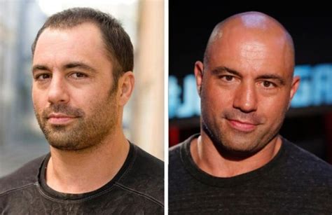 19 Bald Celebrities Before And After Embracing Baldness