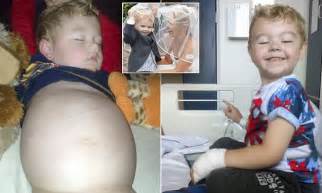 Doncaster Boy Has A Condition That Makes Him Look Pregnant Daily Mail