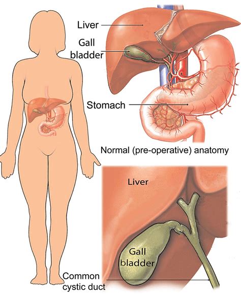 Gallbladder Pain Location Diagram