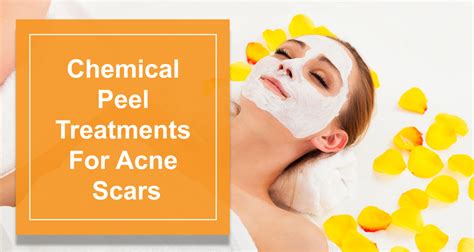 2,233 peel acne scars products are offered for sale by suppliers on alibaba.com, of which microdermabrasion machine accounts for 12%, rf you can also choose from chemical, herbal, and mineral peel acne scars, as well as from exfoliators, acne treatment, and blood vessels removal. Types Of Chemical Peel Treatments For Acne Scars - Best ...