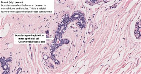 Breast Normal Histology Nus Pathweb Nus Pathweb