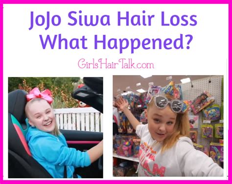 Jojo Siwa Hair Loss What Happened