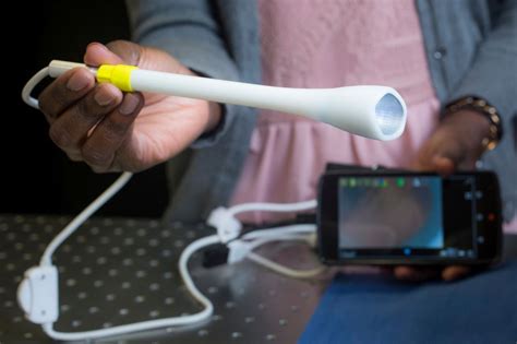 Novel Device Aims To Make Cervical Cancer Screening More Accessible