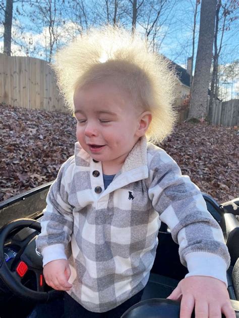 Mom Raises Awareness After Son Is Diagnosed With Uncombable Hair