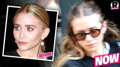 Tragic Turn Ashley Olsens Thinning Hair May Be Due To Lyme Disease