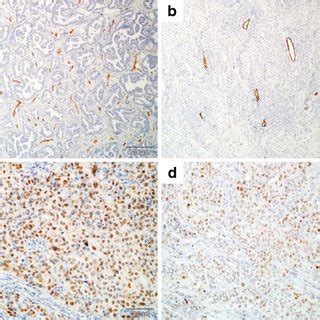 Immunohistochemical Staining Representative Examples Of CD34 Positive