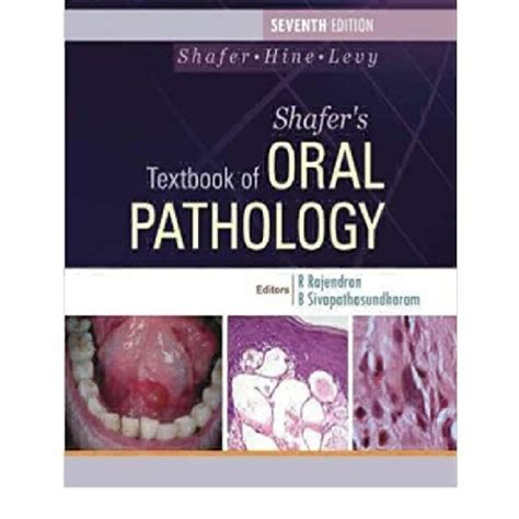 Stream Episode Download Pdf⚡ Shafers Textbook Of Oral Pathology Full