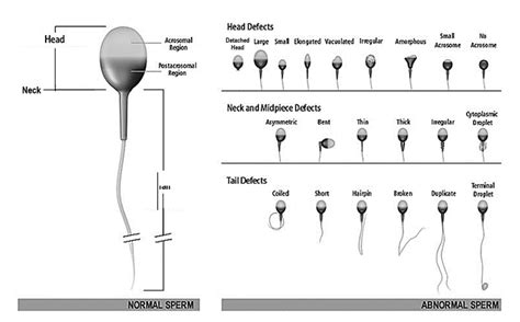 Understanding Sperm Morphology Carolina Conceptions Raleigh