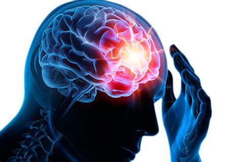 Epilepsie Doctoranytime Blog