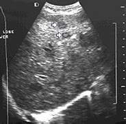 In the framework of such terms as ultrasound of the neck, can be performed the following studies: Cancer Imaging Program (CIP)