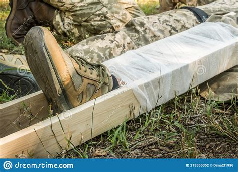 The Damaged Leg Of The Soldier Was Fixed With Boards And A Bandage