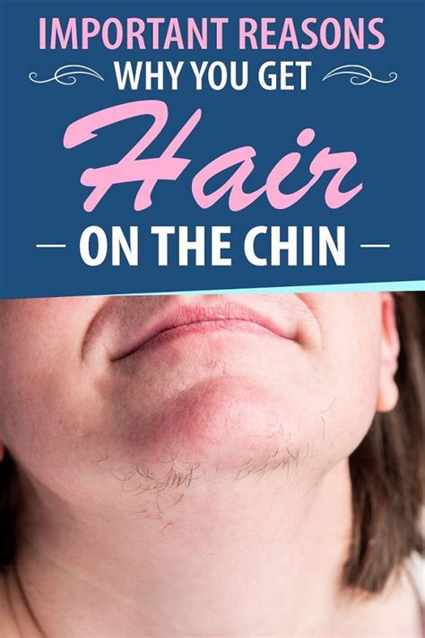 Important Reasons Why You Get Hair On The Chin