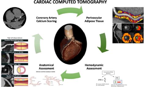 Current And Emerging Roles Of Cardiac Computed Tomography In Predicting
