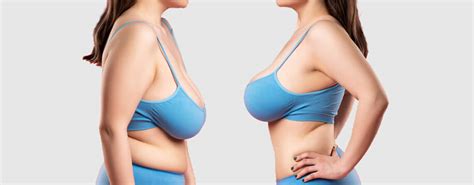 Complete Guide To Breast Reduction Surgery In India