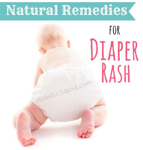 Natural Remedies For Diaper Rash