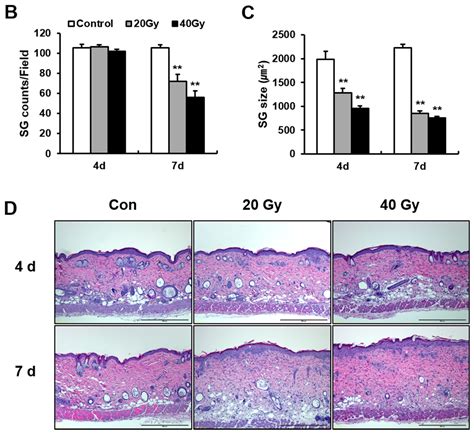 Ijms Free Full Text Impaired Skin Barrier Due To Sebaceous Gland