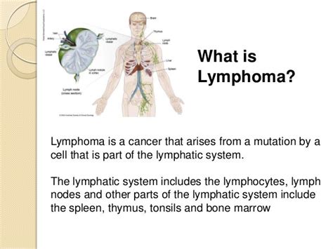 Lymphoma And Radiation
