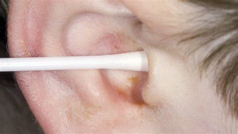 Caution The Ear Wax Can Reveal 4 Health Problems Ear Wax Health