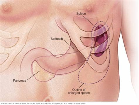 The rib cage is the arrangement of ribs attached to the vertebral column and sternum in the thorax of most vertebrates, that encloses and protects the heart and lungs. Thrombocytopenia (low platelet count) Disease Reference ...