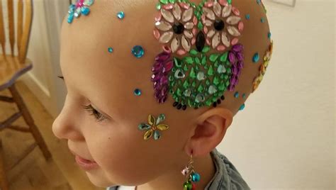 7 Year Old Girl With Alopecia Rocks Several Creative Looks