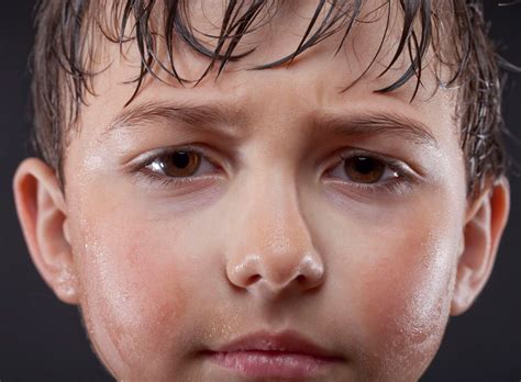 3 Causes Of Excessive Sweating In Kids Know Whats Hyperhidrosis
