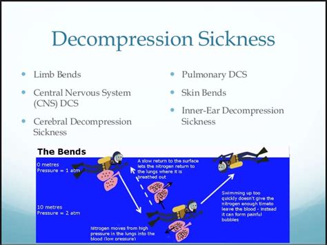 Medical School Decompression Sicknesswhat To Know Decompression