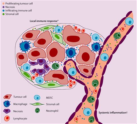 Cancer Related Inflammation And Treatment Effectiveness The Lancet