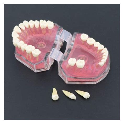 Buy Tooth Modelorgan Model Lmeili Dental Standard Model With Removable