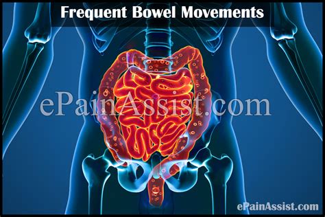 Frequent Bowel Movements Treatment Causes Symptoms