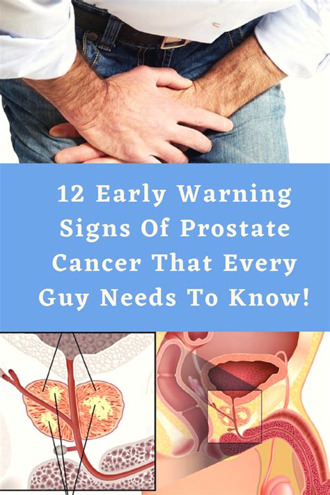 Early Warning Signs Of Prostate Cancer That Every Guy Needs To Know