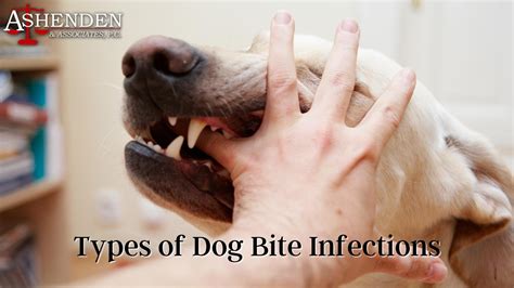 Can U Get Tetanus From A Dog Bite