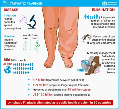 What Is Lymphatic Filariasis Lf Haiti Salt Project