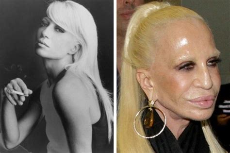 Before Plastic Surgery Journey How Versace Changed Herself Into A Human Waxwork Cute Smile Com