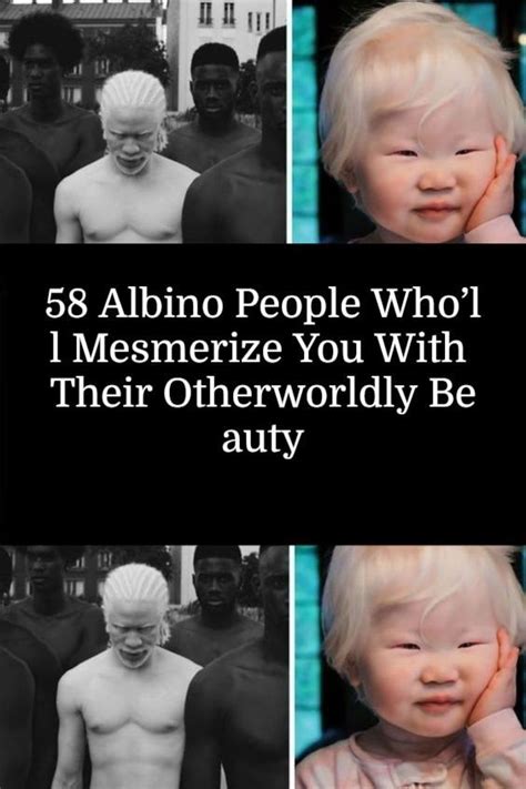 Albino People Wholl Mesmerize You With Their Otherworldly Beauty Albino Photo Series People
